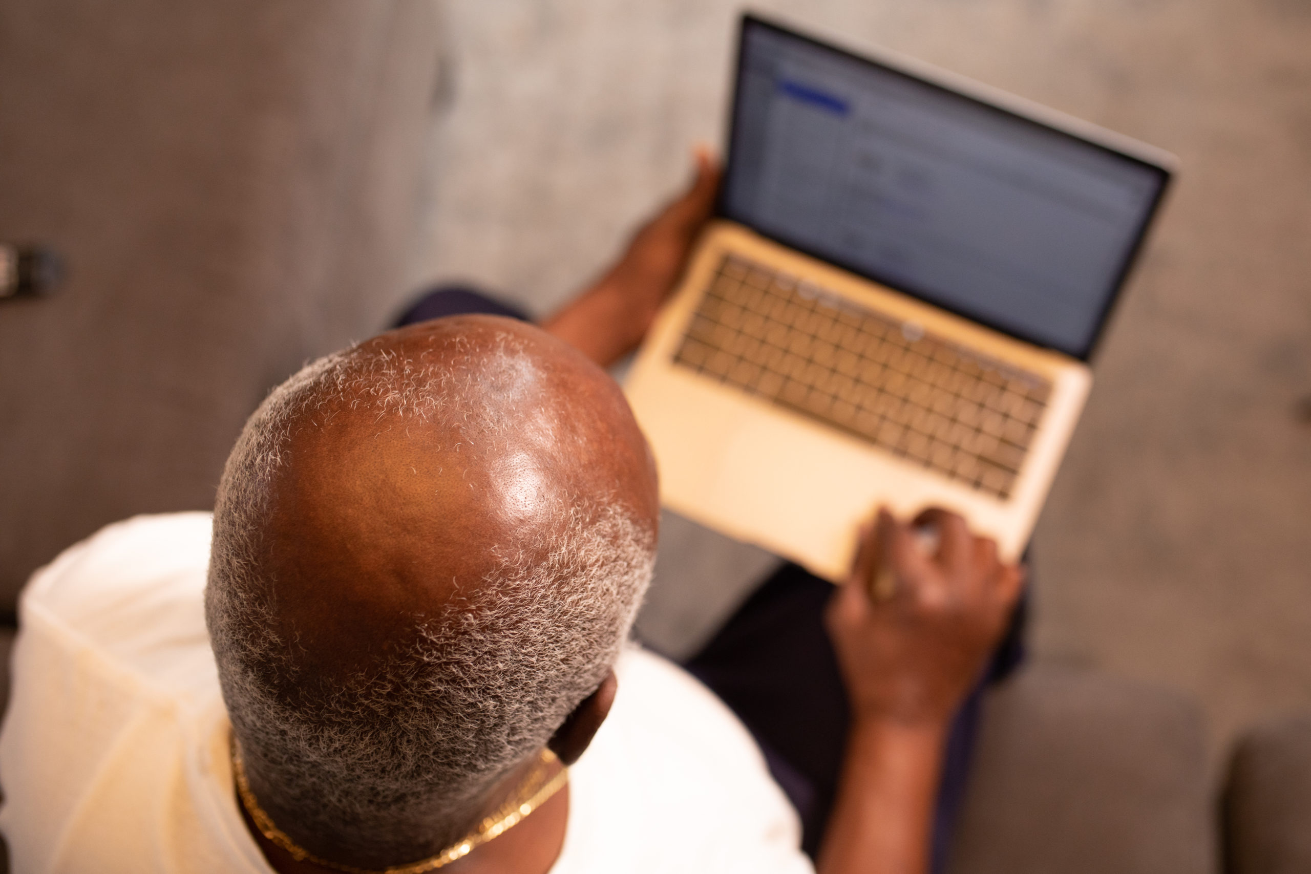 Understanding Male Pattern Baldness Genetics: What You Need To Know