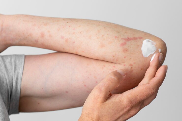 skin-allergy-reaction-person-s-arm 23-2149140478