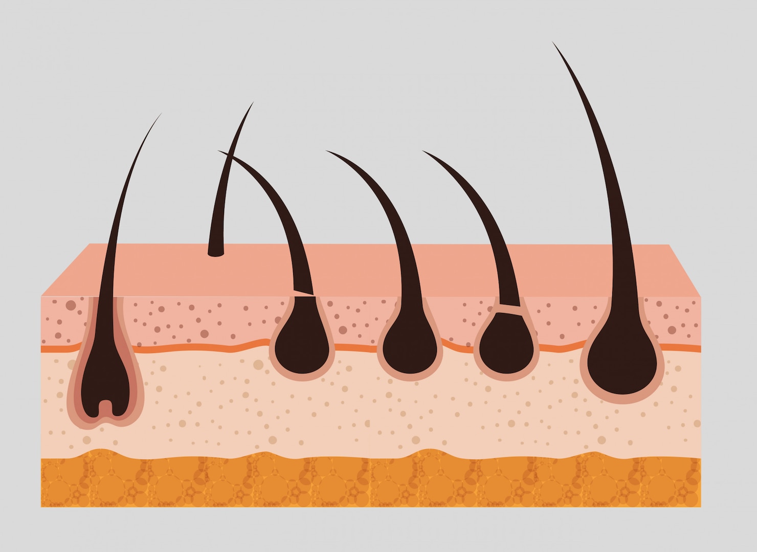 layered-skin-structure 24877-54530