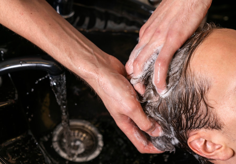 Defeating Dandruff: 5 Best Dandruff Shampoo for Men