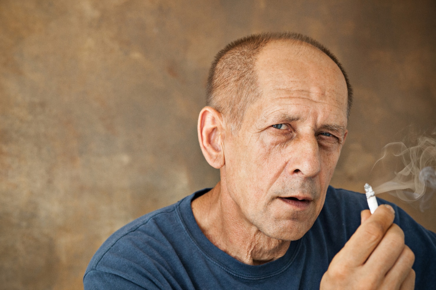 Smoking And Hair Health: Does Nicotine Cause Hair Loss?