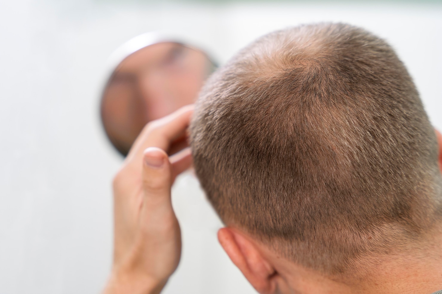 Breaking the Stigma: Coping with Hair Loss in Men