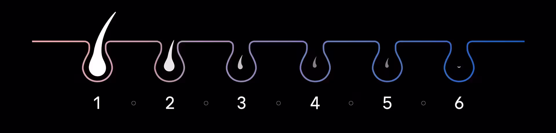 Grafik veranschaulicht die sichtbare Reduzierung der Haare in der Haut zwischen der ersten und der sechsten Sitzung. Grafik veranschaulicht die sichtbare Reduzierung der Haare in der Haut zwischen der ersten und der sechsten Sitzung.