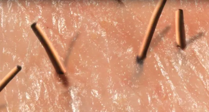 I peli della barba sono duri, fibrosi e crescono in diverse direzioni casuali