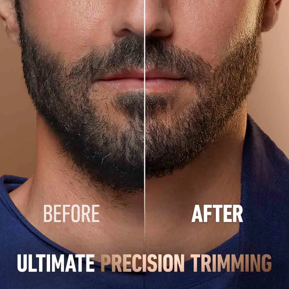 [en-ca]-KCG Beard Trimmer Pro-4