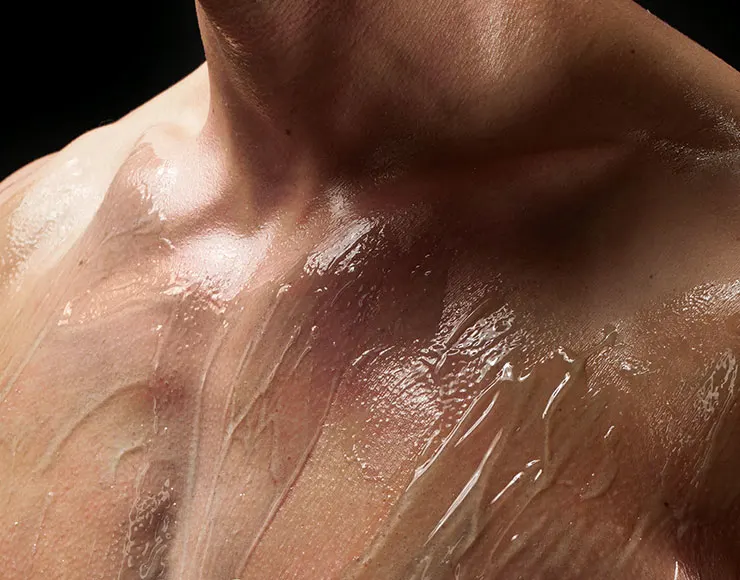 acne prone skin