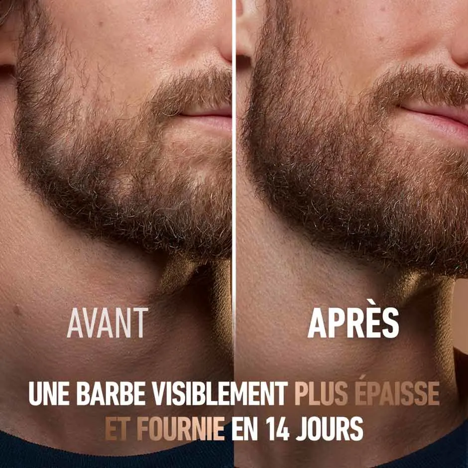 [fr-ca]-KCG Beard Thickening Serum-4