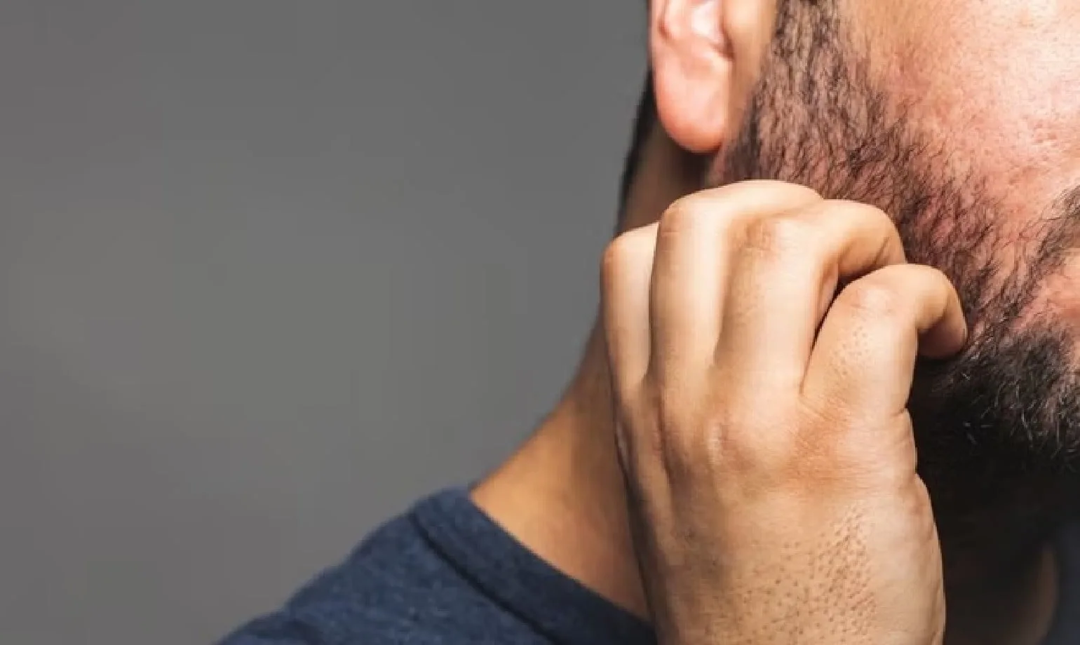 Cos’è la forfora della barba?