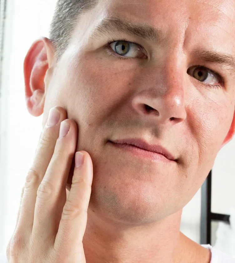 Acne Prone Skin