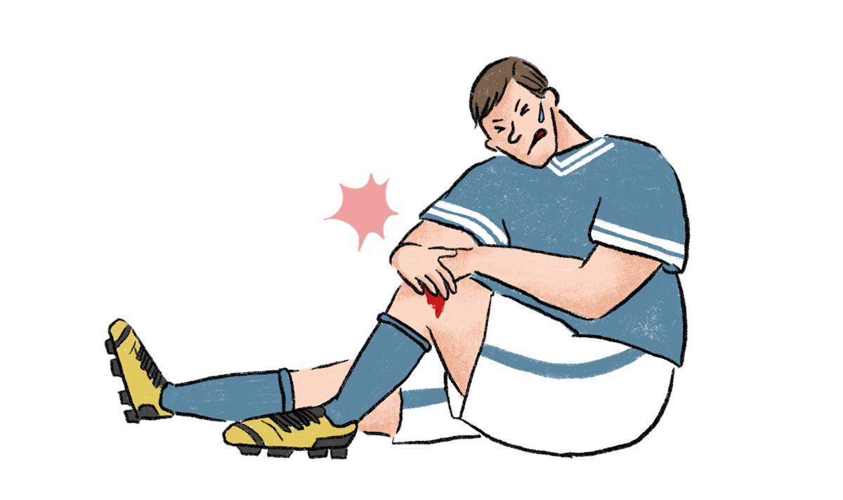 止血方法｜TORCH