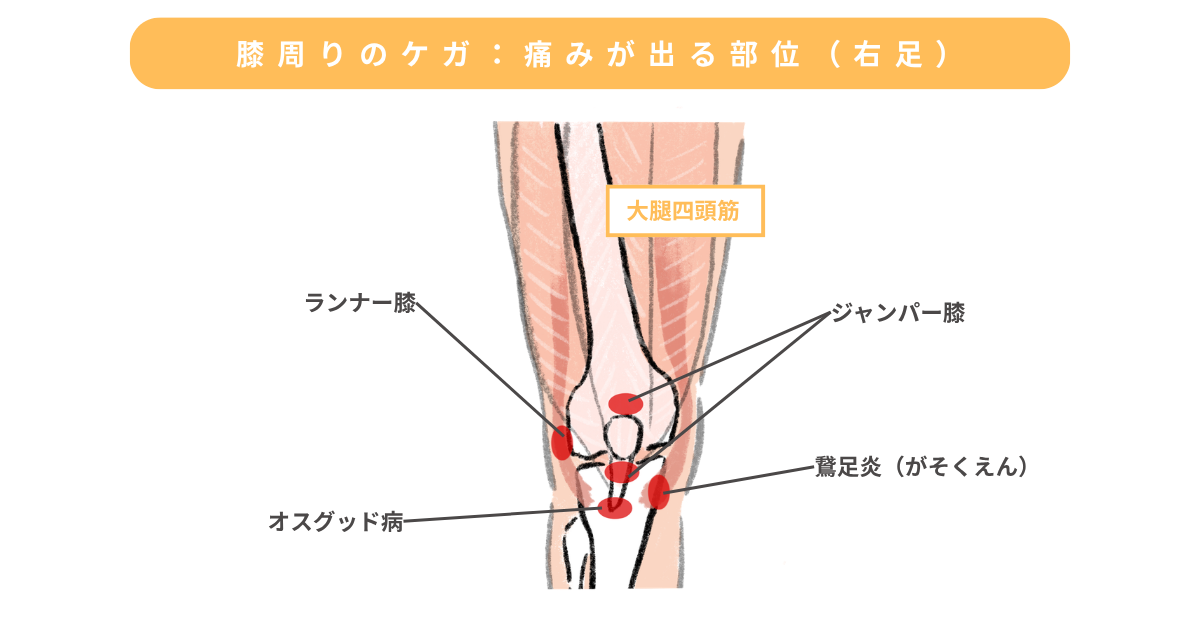 Various knee injuries