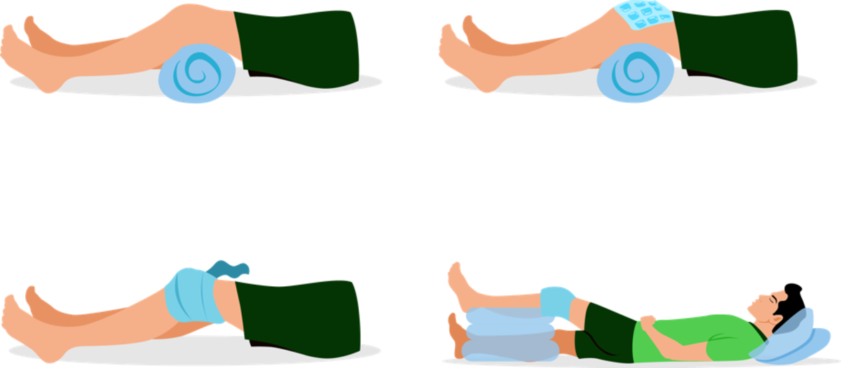 打撲や捻挫などの応急手当て