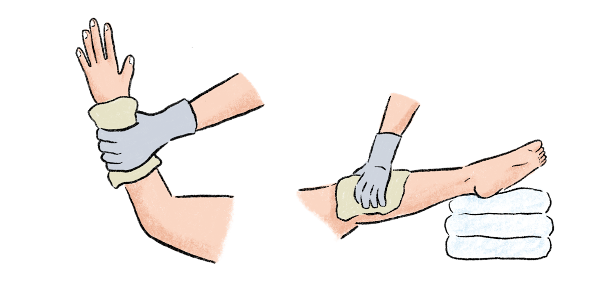 止血の方法｜TORCH