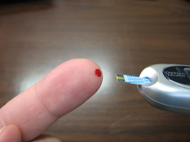 Blood glucose finger prick testing