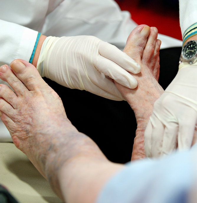 man with type 2 diabetes having a foot exam to check for diabetic neuropathy