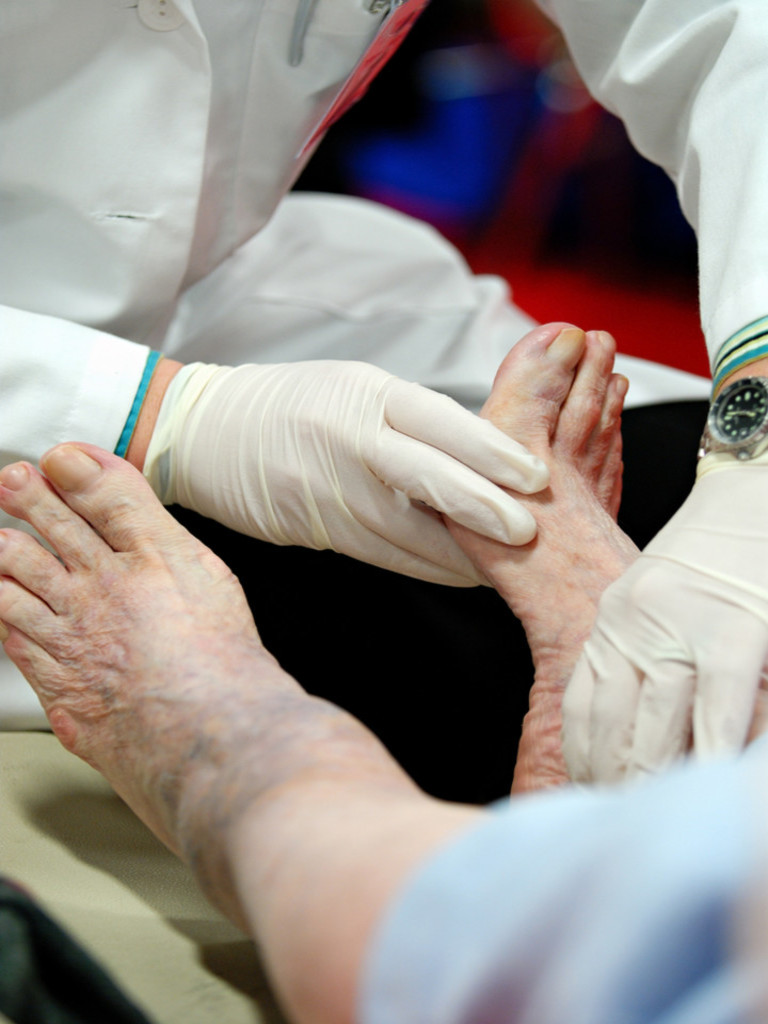 man with type 2 diabetes having a foot exam to check for diabetic neuropathy