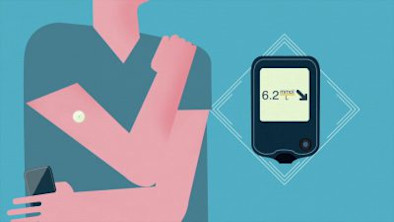 flash glucose monitoring device on person