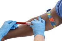 African American male with type 2 diabetes having a blood test to test for prediabetes