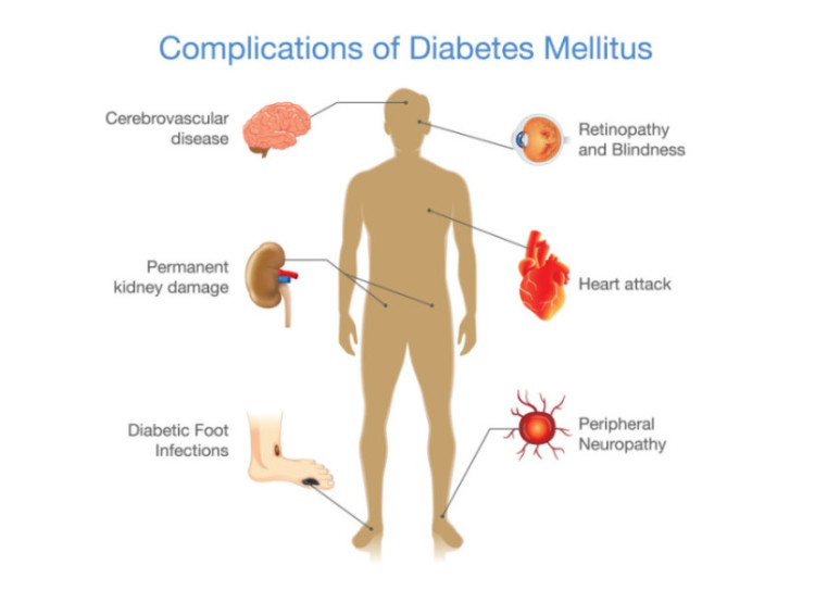 complications of diabetes infographic - full size