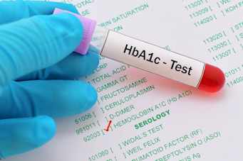 This is a Hba1c image