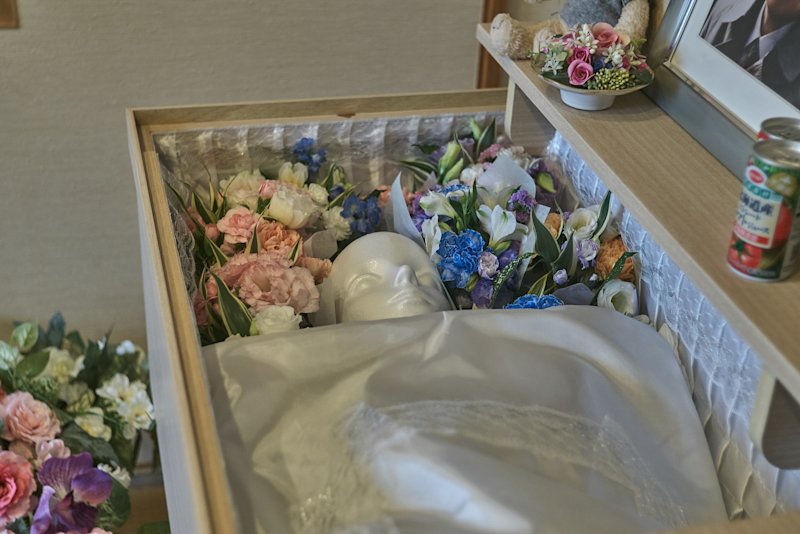 ご遺体の顔に変化がある場合の自宅でできるケアをご紹介