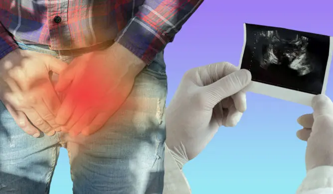 The cost of prostate cancer treatment