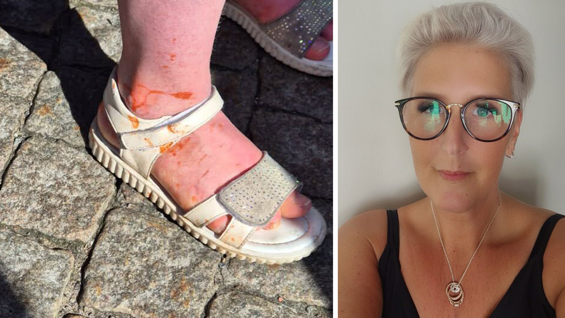 Downs syndrom-sällskap attackerat – med stinkande 