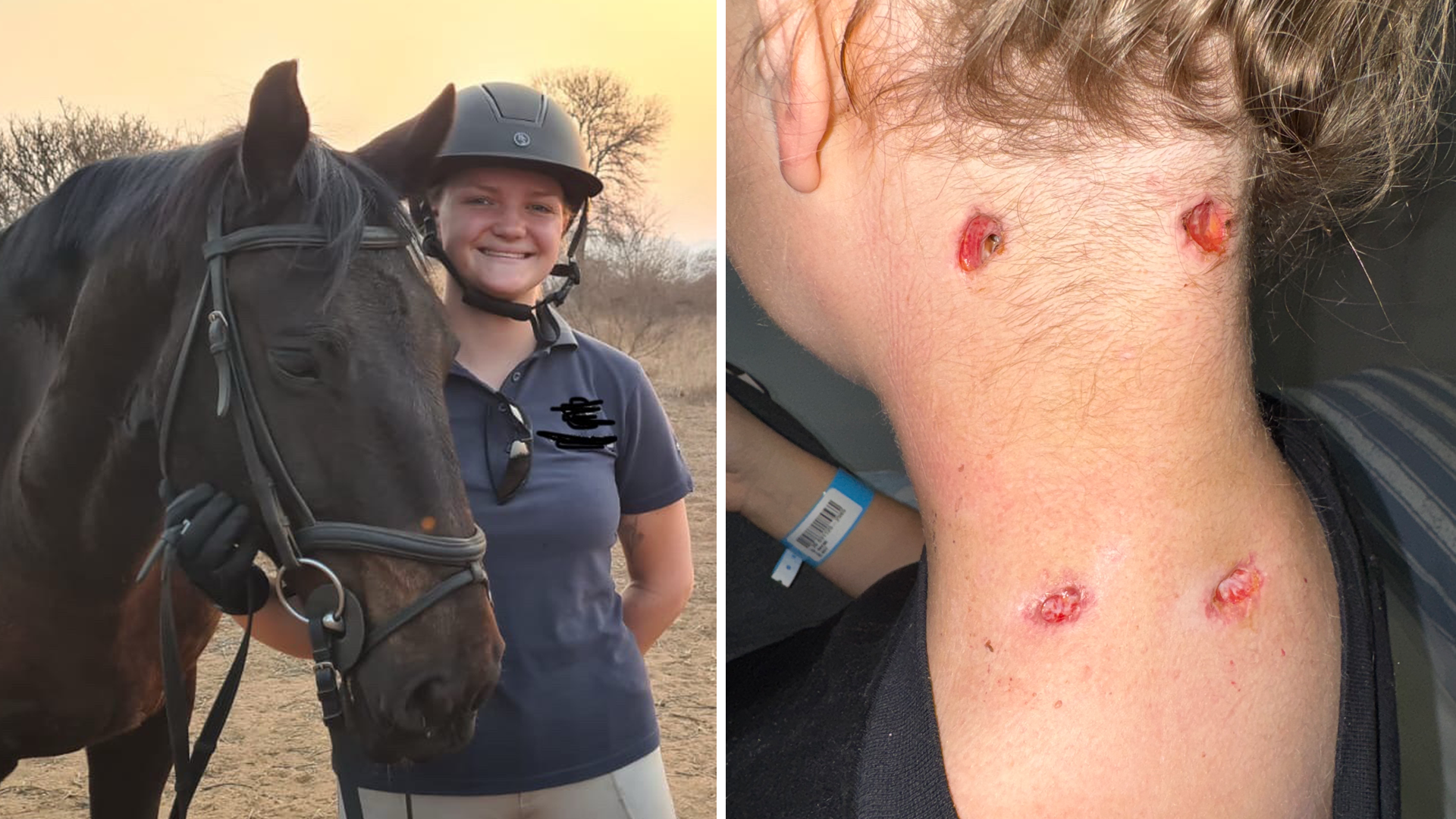 Svenska Naemi överlevde lejonattack: ”Vill absolut tillbaka”