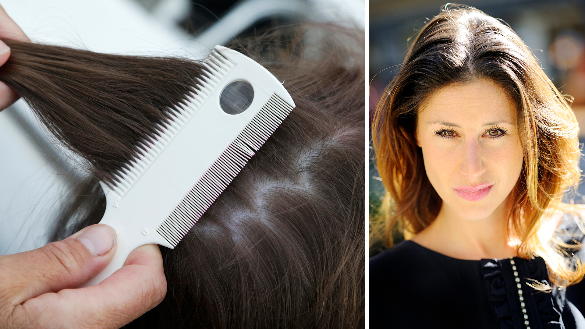 Katrin Zytomierska rasar: Folk tar inte huvudlöss på allvar