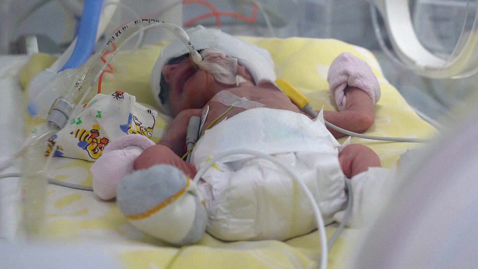 Antalet barn som föds för tidigt i Ukraina ökar: ”Akut stres