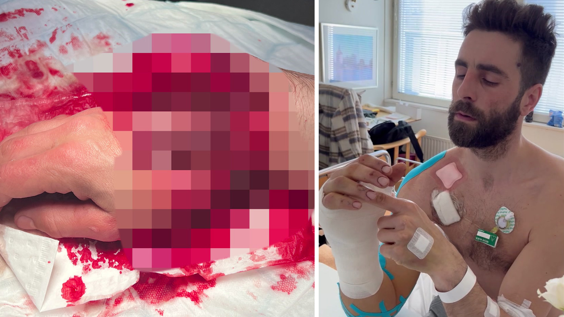 Så här säkerställer du att Joels hand inte slits av i gripklo: 5 tips för att undvika skador