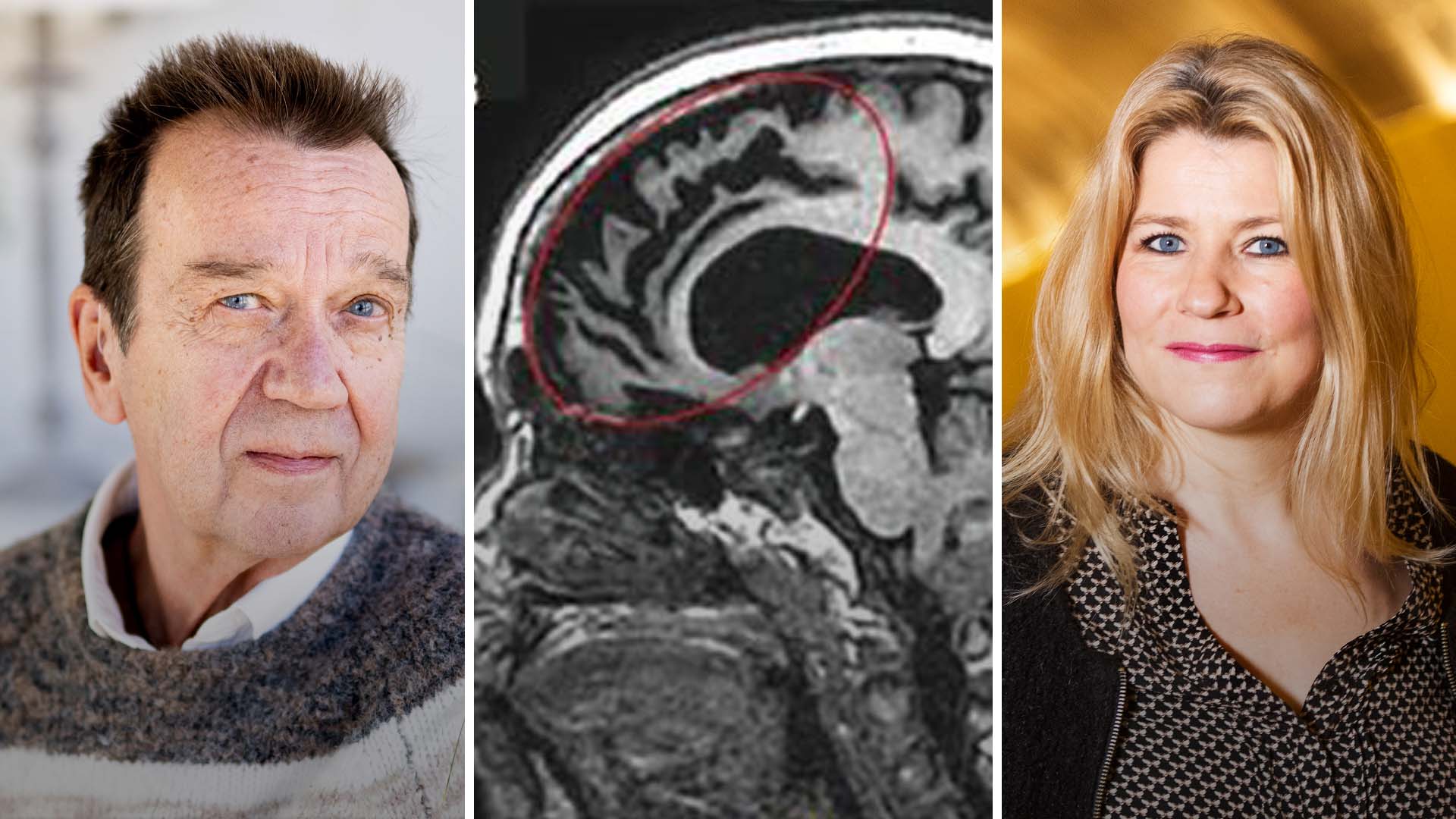 Björn Skifs: Så påverkar ovanlig demens livet vid 78 år – en unik inblick i hans kamp.