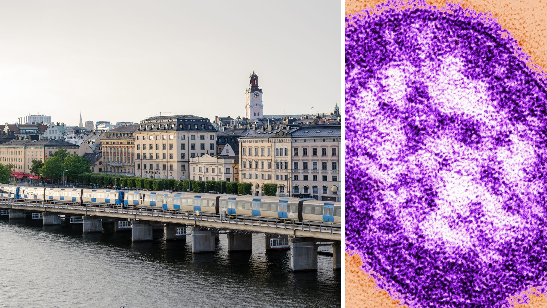 FHM om mässlingfallet: Behöver inte vara orolig