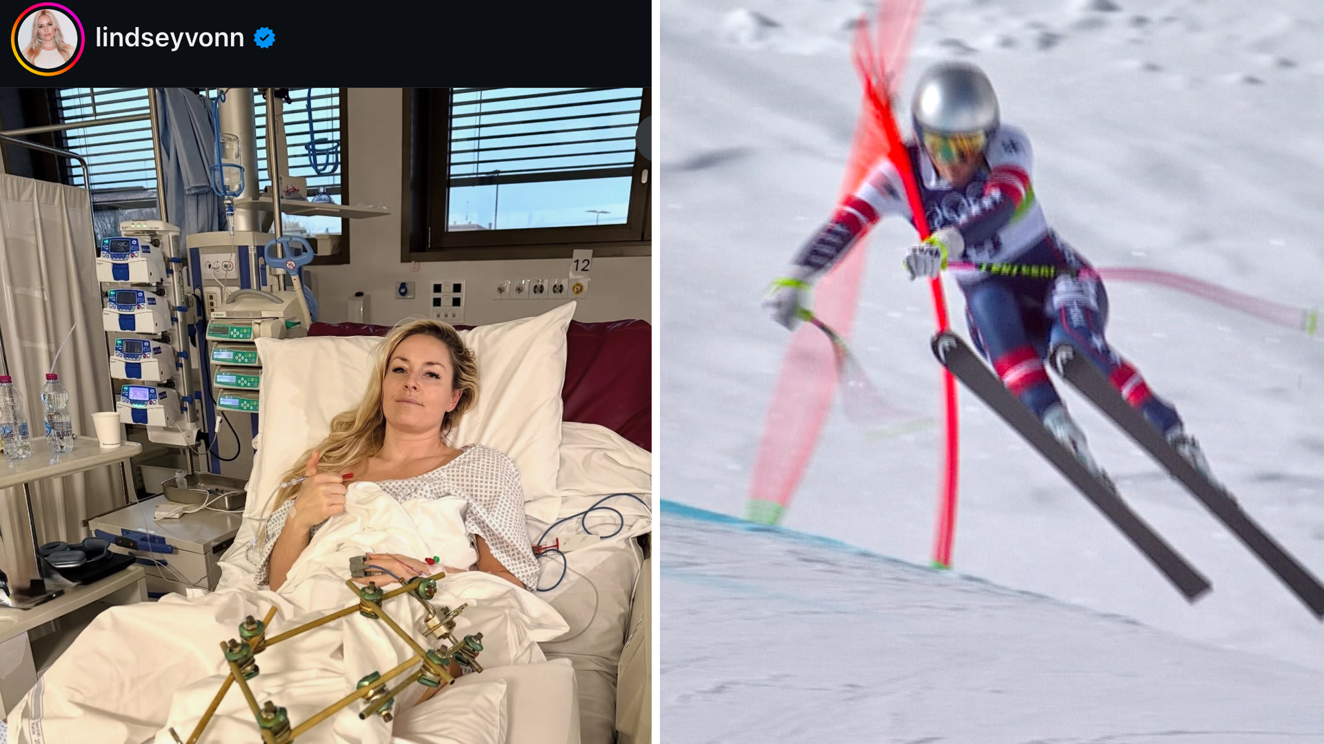 Första bilden på Lindsey Vonn från sjukhuset