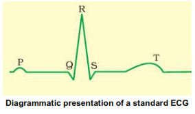 ECG Graph