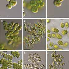 Algae (chlorophyta)