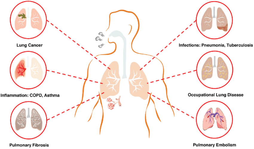 common respiratory disorders
