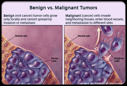 Tumors