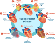 Cardiovascular Diseases Study Guide Inspirit