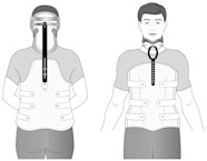 Principles And Components Of Spinal Orthoses ScienceDirect 48 OFF