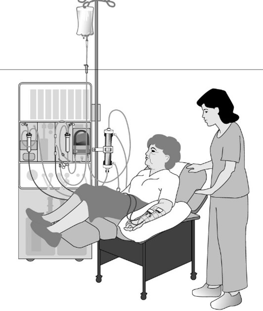 Hemodialysis