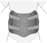 LSO (Lumbosacral orthosis)