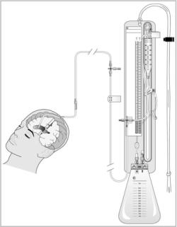 icu equipment