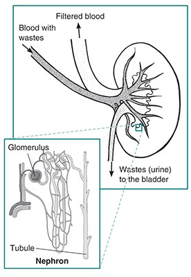 glomerulonephritis images