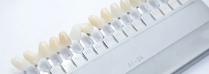 Tandfasader – hur går det till? article banner