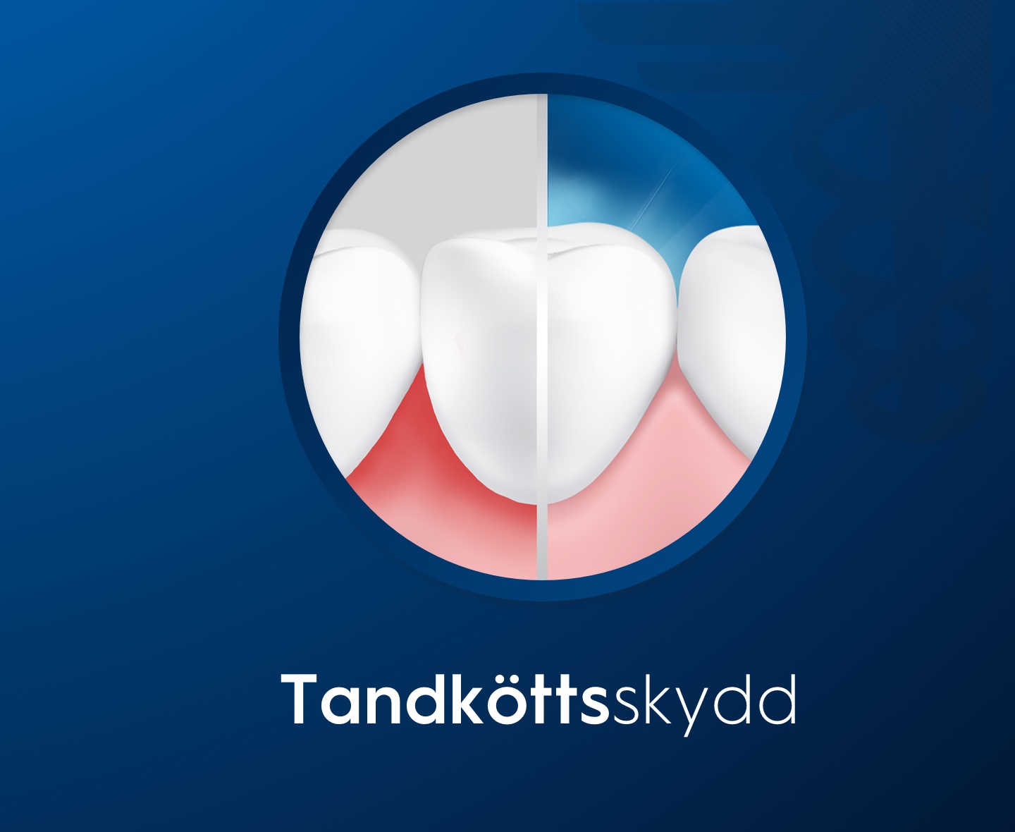 Tandköttsskydd