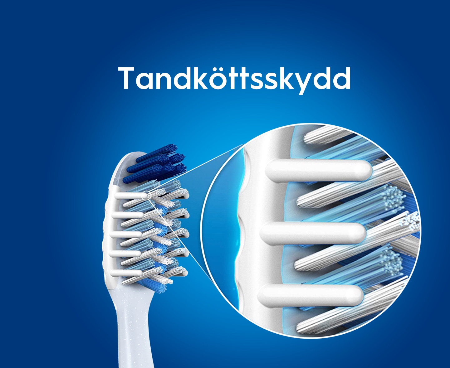 Tandköttsskydd