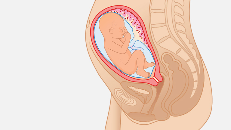 28 неделя болит живот. Плод на 26 неделе беременности. Расположение плода на 26 неделе беременности. Малыш на 26 неделе беременности в животе. Расположение малыша в животе.