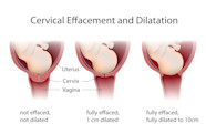 Cervical Effacement What You Need To Know