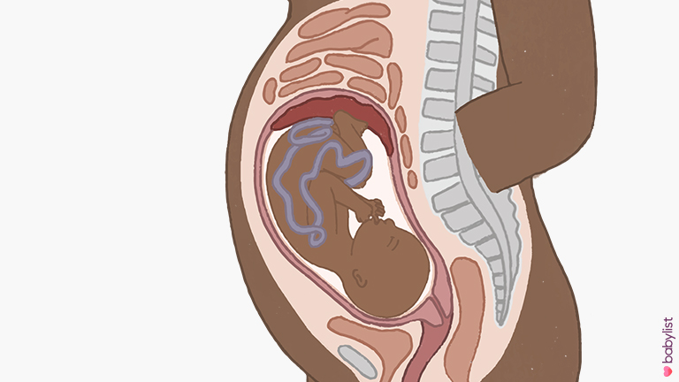 Pregnancy-Ultrasound-week-32
